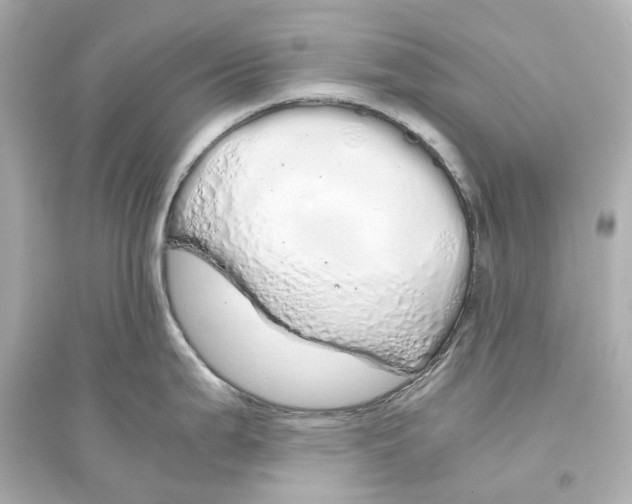 X0000093771199200711131204