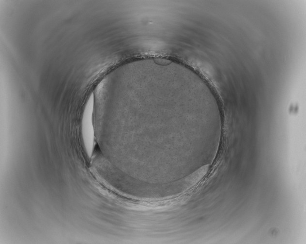 X0000094070017200711021520