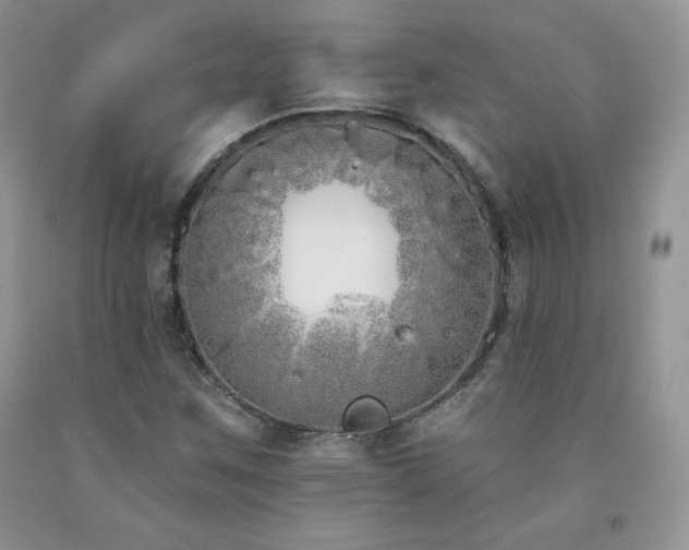 X0000094171259200710261100