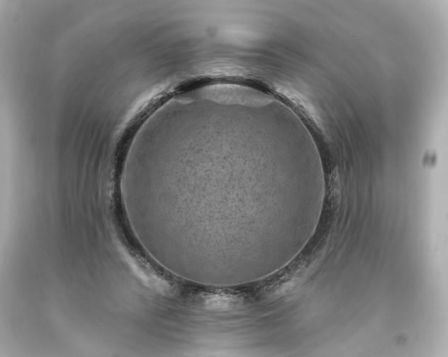 X0000094170400200711020946