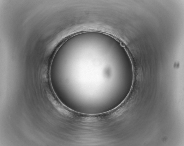 X0000094171499200711020928