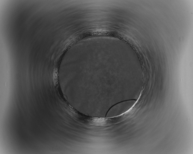 X0000094170144200711091131
