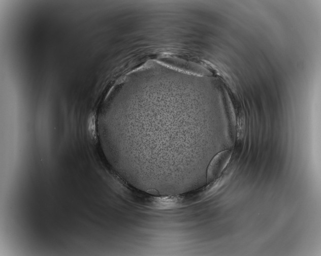 X0000094170238200711091130