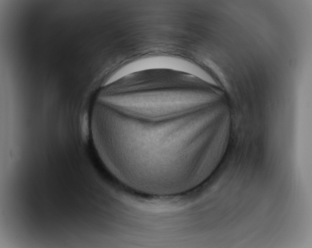 X0000094170020200711161717