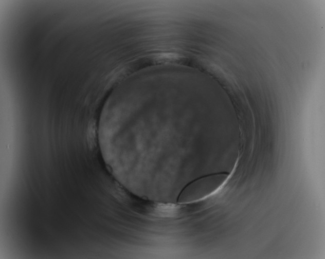 X0000094170144200711161715