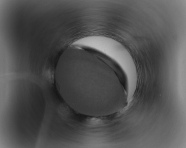 X0000094170180200711161715