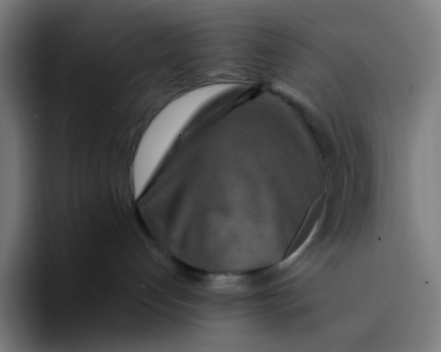 X0000094170192200711161715