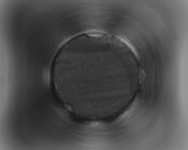 X0000094170204200711161714