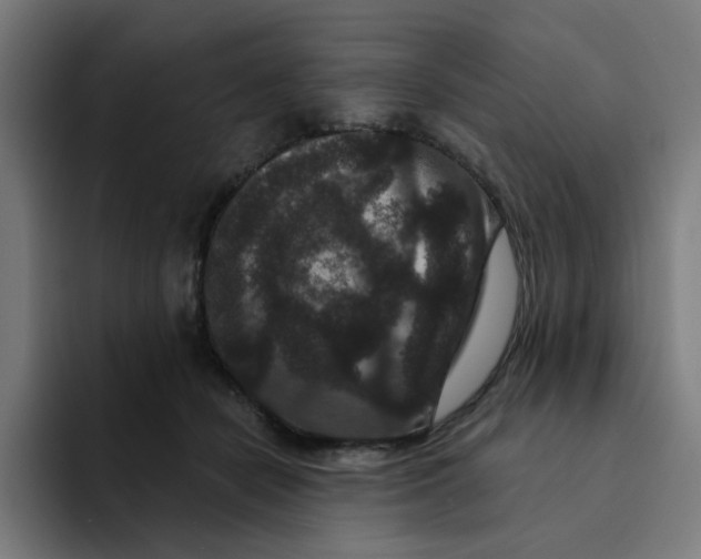 X0000094170462200711161711