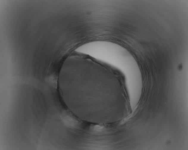 X0000094170180200711241538