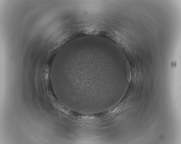 X0000094181154200711020958