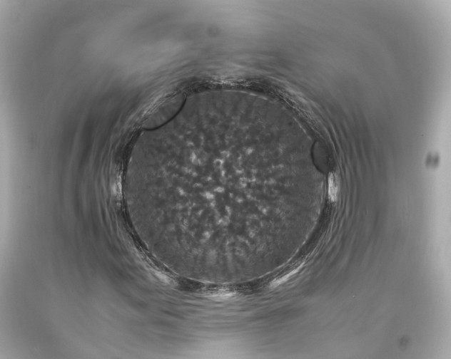 X0000094181155200711020958