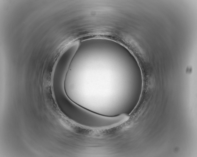 X0000094181169200711020958