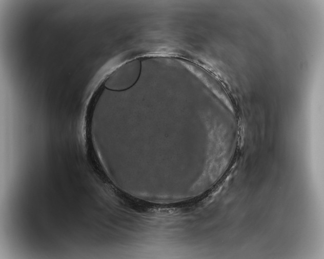X0000094180296200711091147