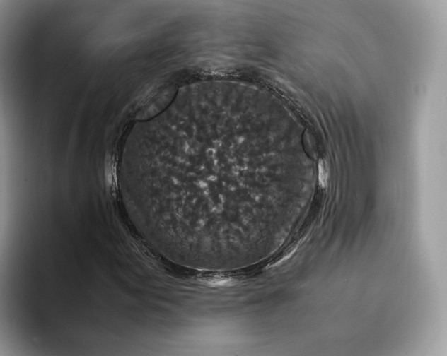 X0000094181155200711091137