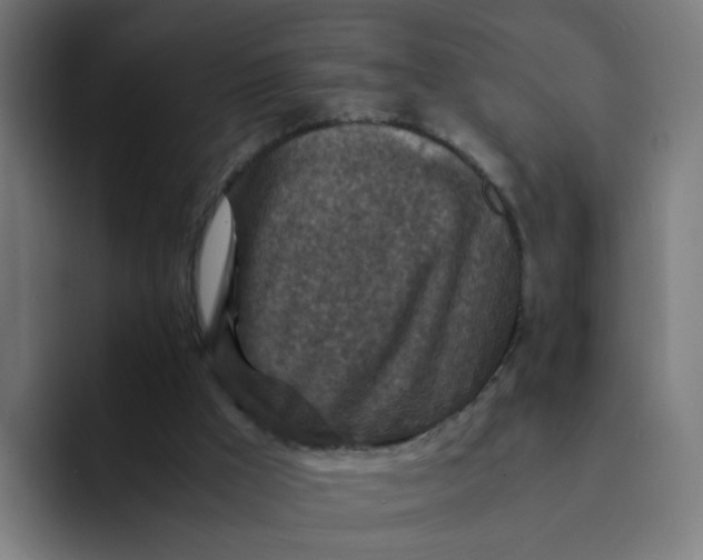 X0000094180009200711161737