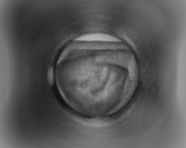 X0000094180020200711161737