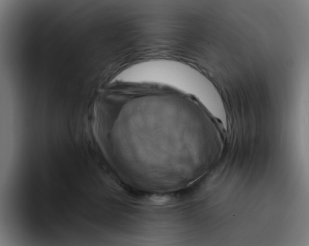 X0000094180570200711161730