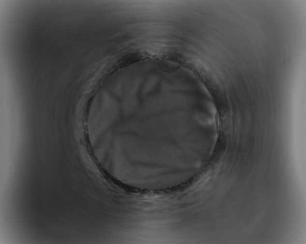 X0000094181009200711161723