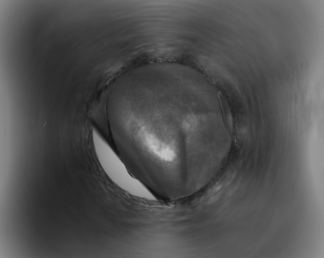 X0000094181010200711161723