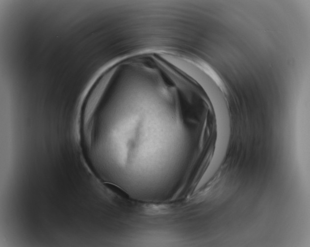 X0000094181148200711161723