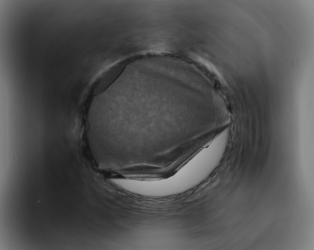 X0000094181160200711161722