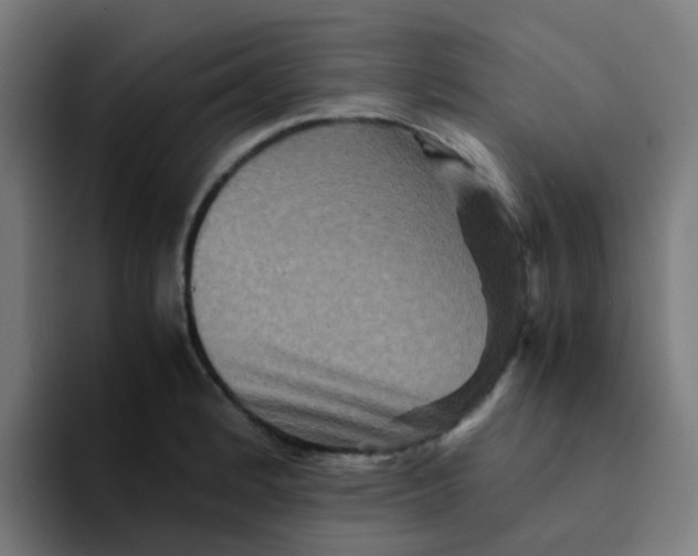 X0000094181184200711161722