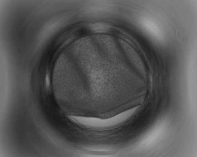 X0000094181198200711161722