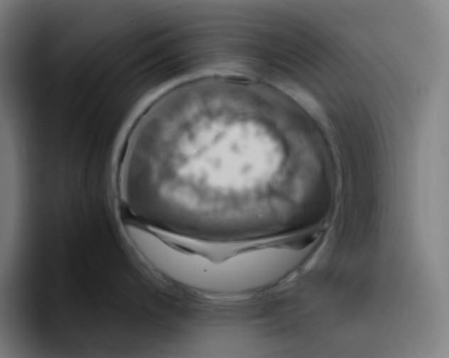 X0000094181200200711161721