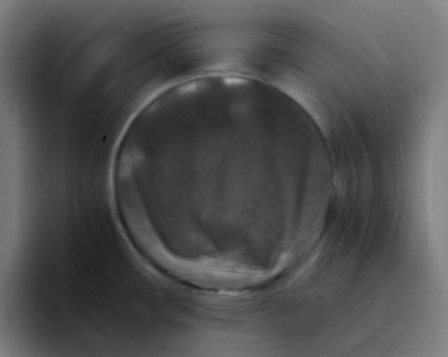 X0000094181482200711161718