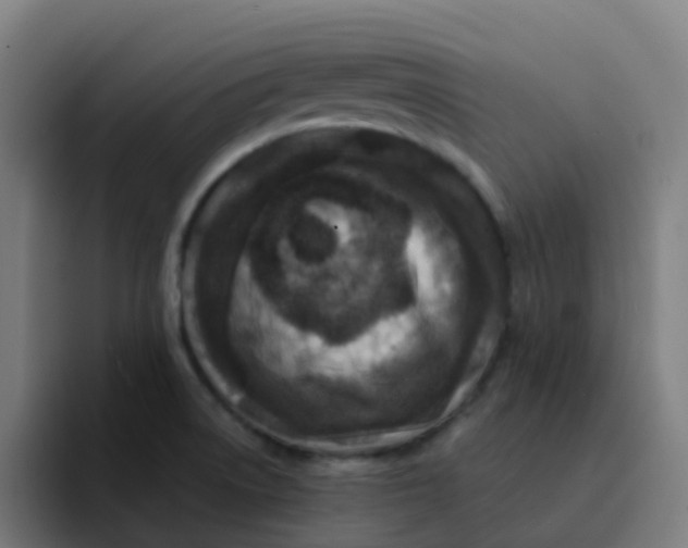 X0000094181522200711161718