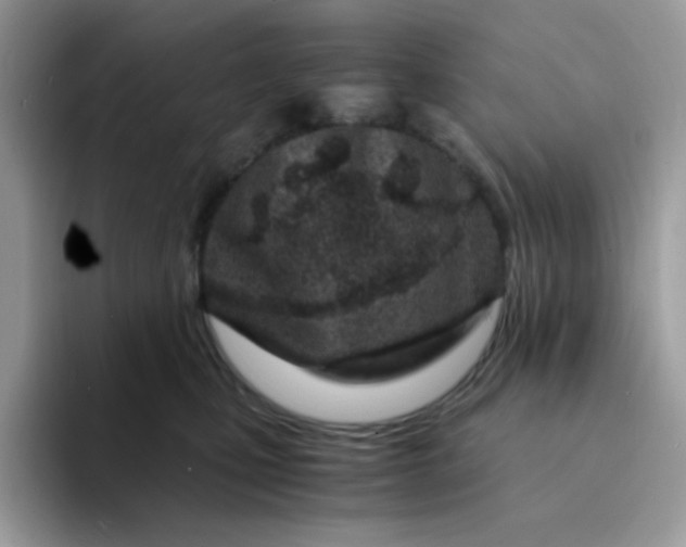 X0000094200471200711091222