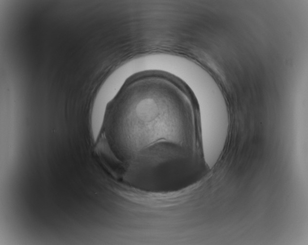 X0000094200027200711161817