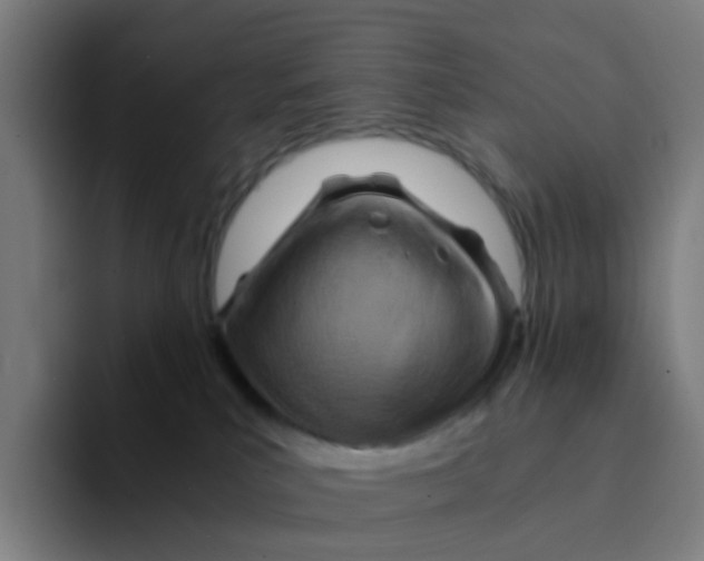 X0000094200039200711161817