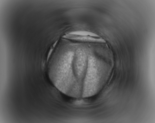 X0000094200177200711161815