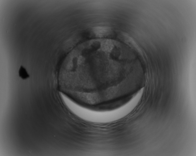 X0000094200471200711161812