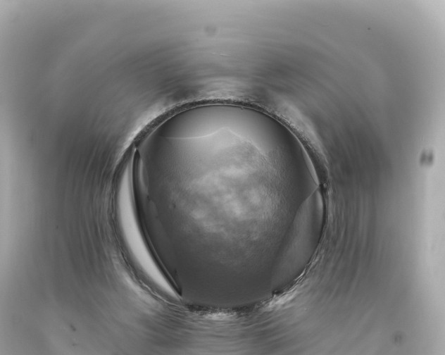 X0000094220156200711021147