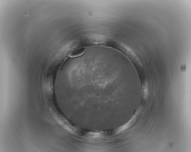 X0000094220170200711021148