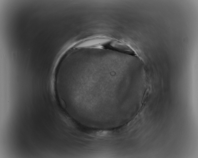 X0000094220152200711161856