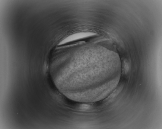 X0000094220176200711161856