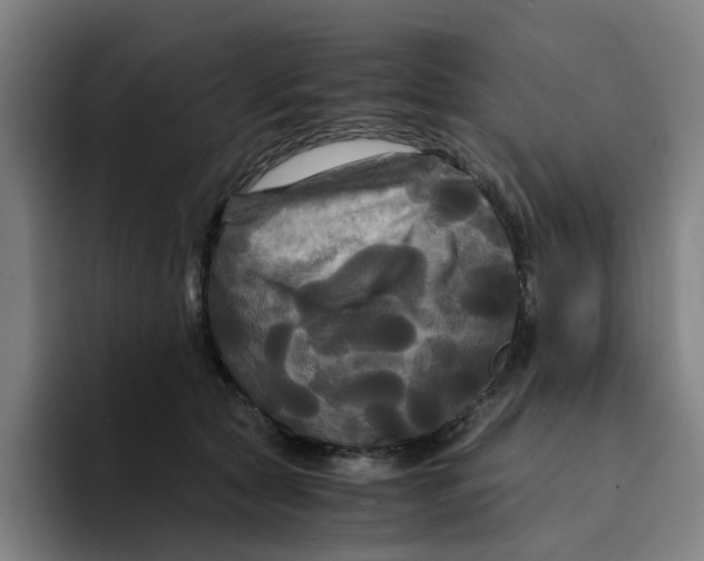 X0000094220561200711161851