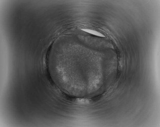 X0000094330520200711301231