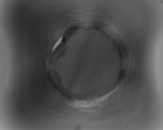 X0000094340041200711162018