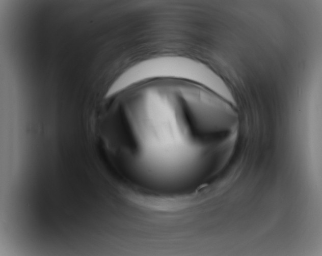 X0000094340044200711162018