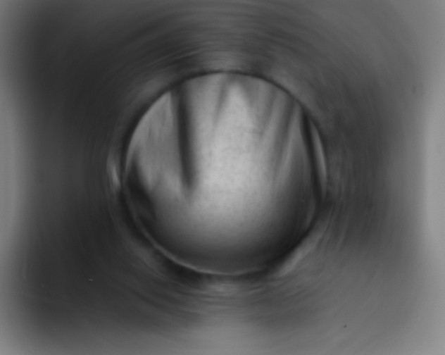 X0000094340062200711162018