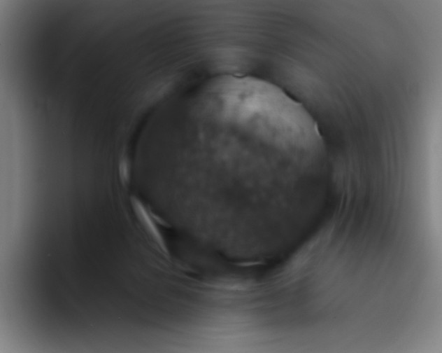 X0000094340076200711162018