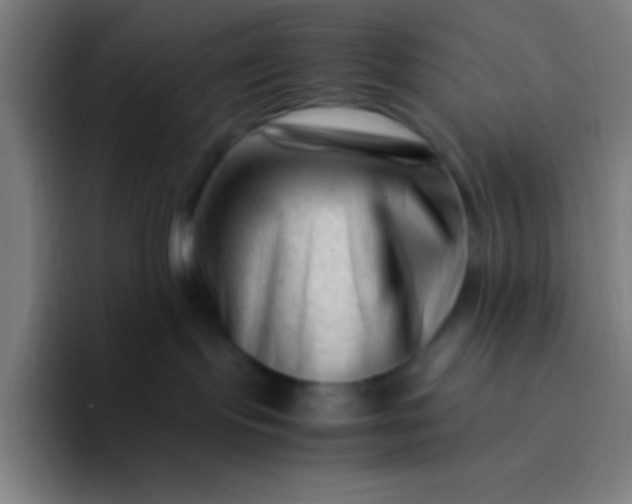 X0000094340095200711162018