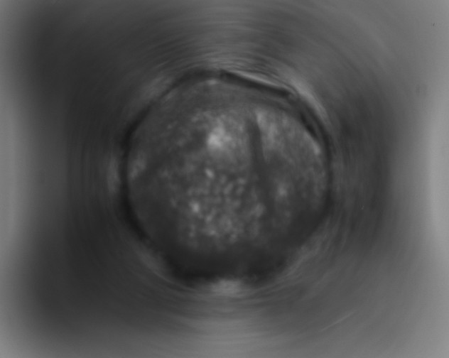 X0000094340114200711162018