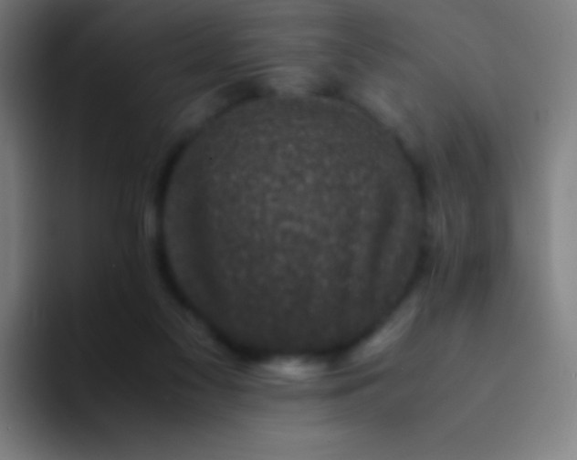 X0000094340117200711162017