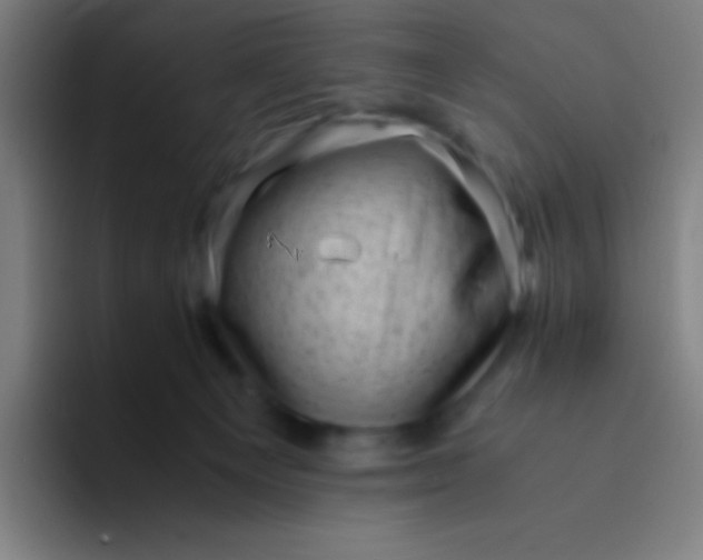 X0000094340129200711162017